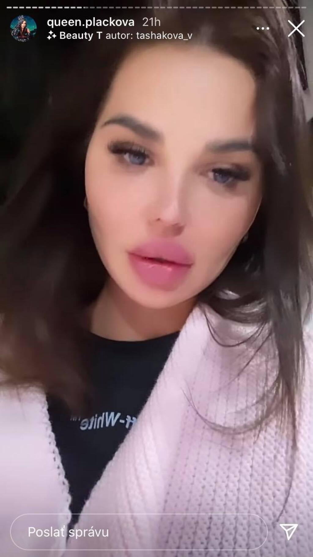 Plačková to v Jasnej prehnala s alkoholom a točila videá, ktoré neskôr zmazala.