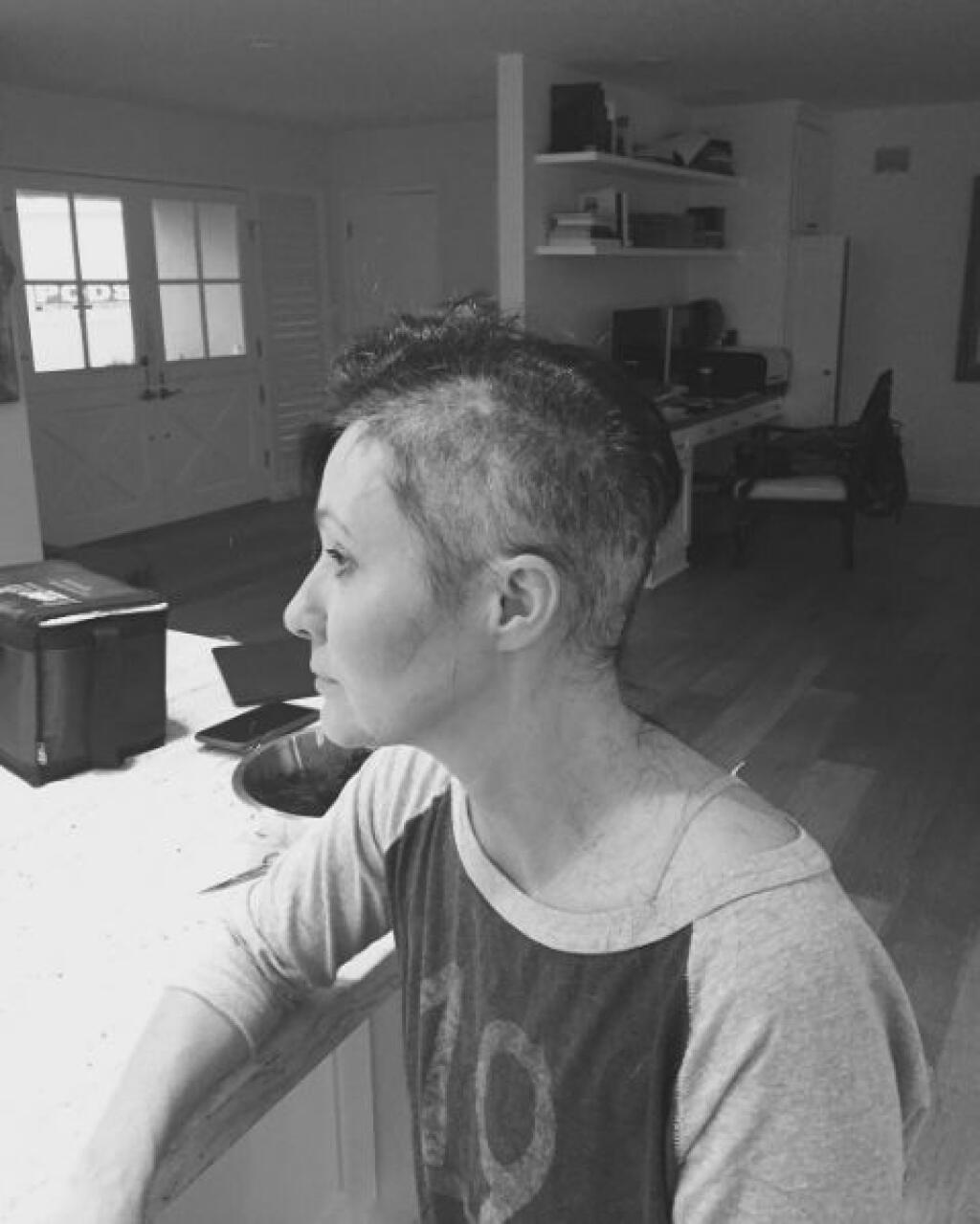 Shannen Doherty sa rakovina rozšírila a po niekoľkonásobnej chemoterapii prišla o vlasy.