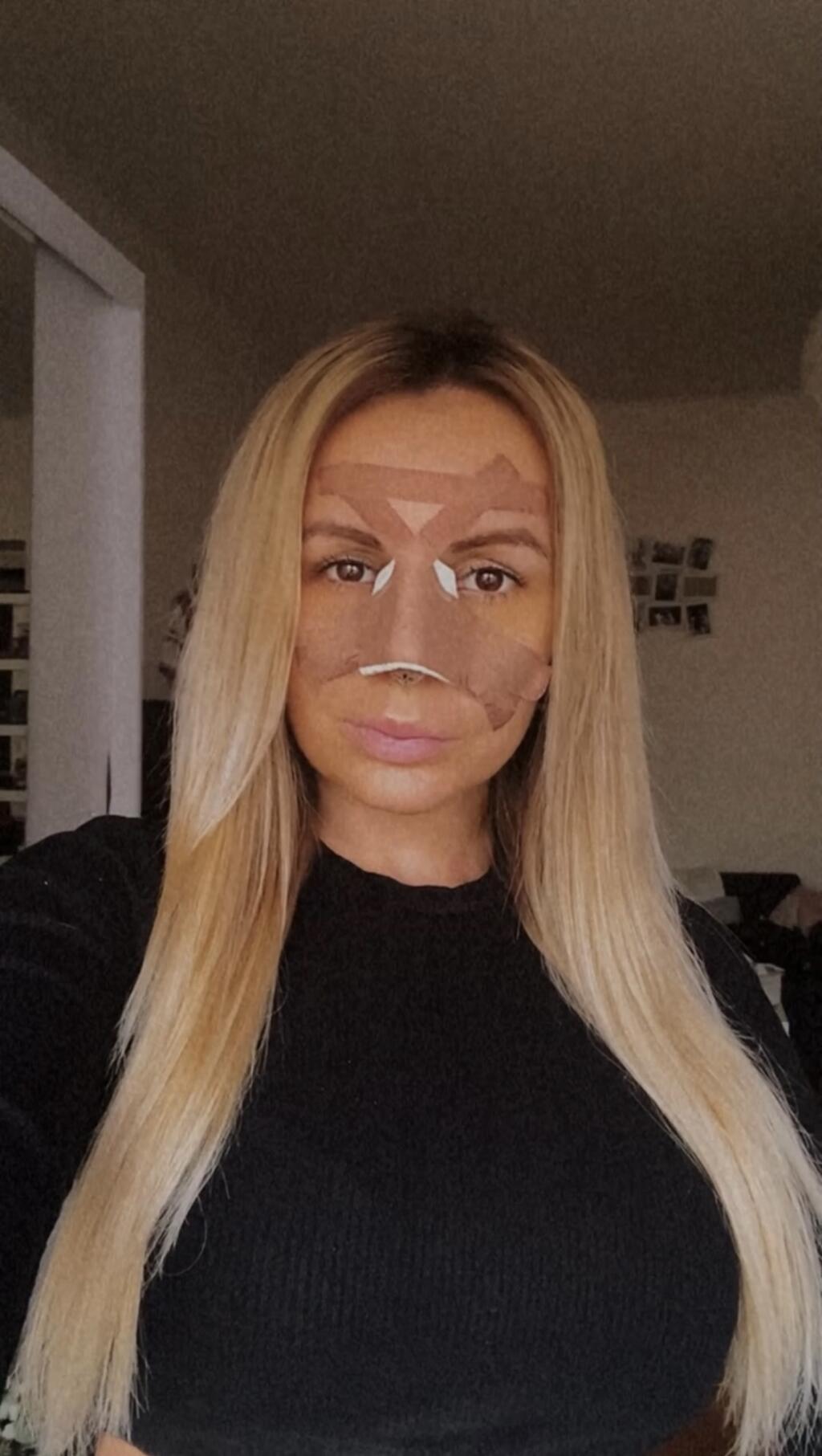 Atraktívna prsatica si nechala upraviť nos, ktorý jej robil vrásky na čele.