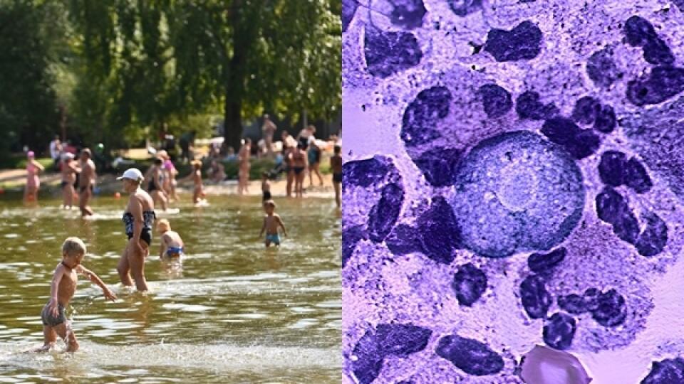 Parazitický prvok Naegleria fowleri napáda mozgové bunky, ktorými sa živí.