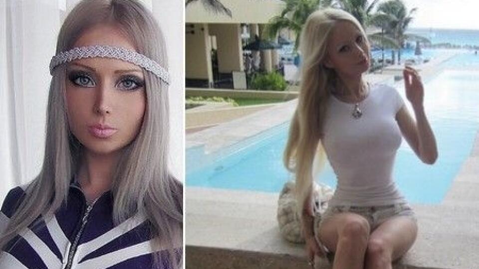 Ukrajinka Valéria sa na Barbie podobá tvárou,
