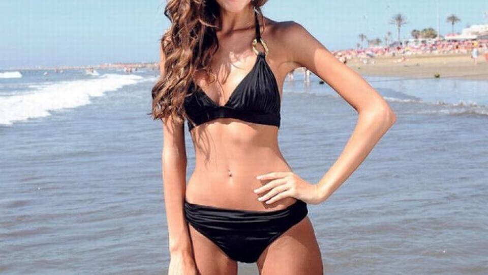 Česká modelka Eliška Bučková priznala anorexiu.