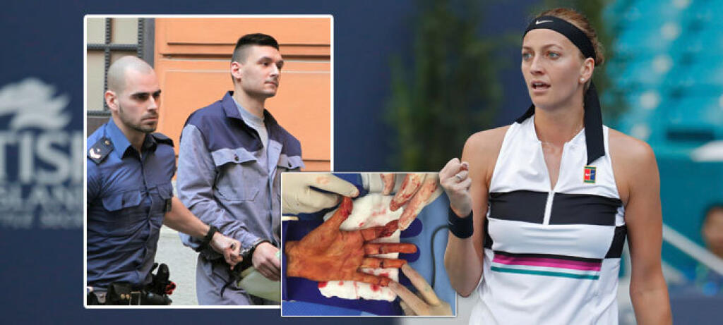 Petra Kvitová sa ukázala na párty v krátkych šatách.