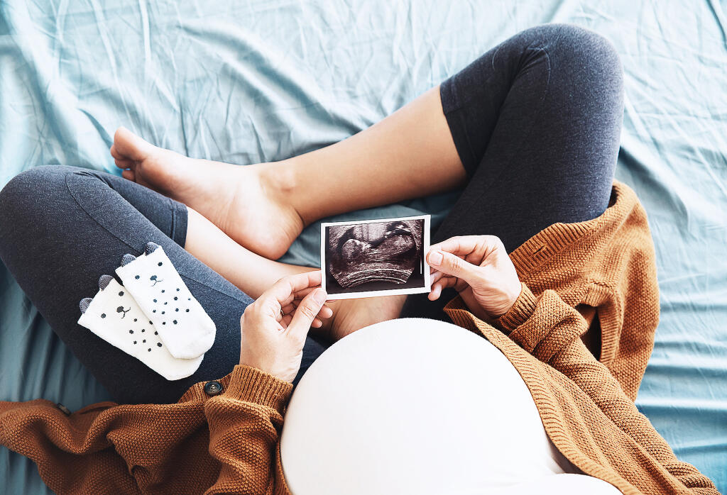 Pregnant,Woman,Holding,Ultrasound,Image.,Concept,Of,Pregnancy,,Health,Care,