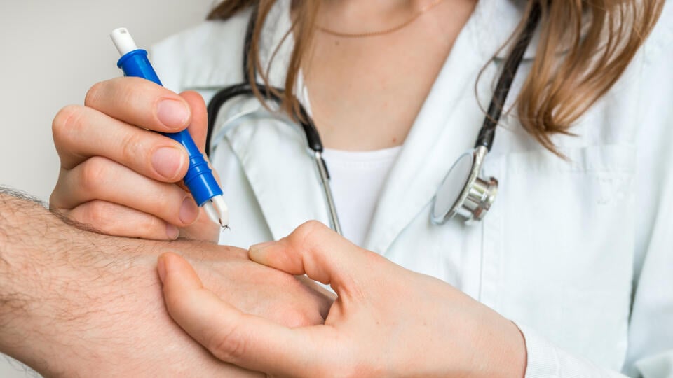 Podľa lekárky sa vyberania kliešťa v domácich podmienkach netreba báť. Stačí, keď máte pinzetu a dezinfekciu, ktorú pred výberom aplikujete na postihnuté miesto.
