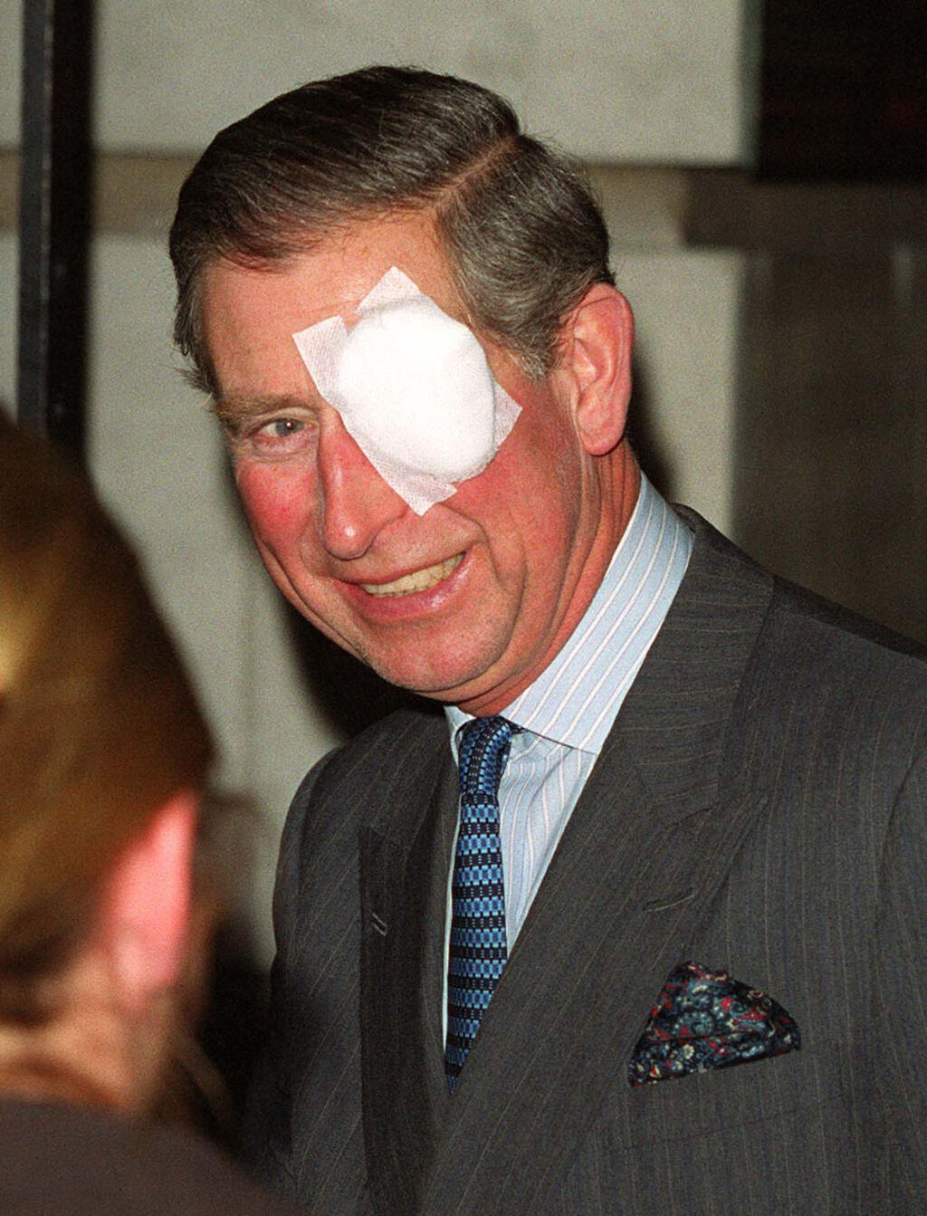 Princ Charles a jeho zákrok na oku.