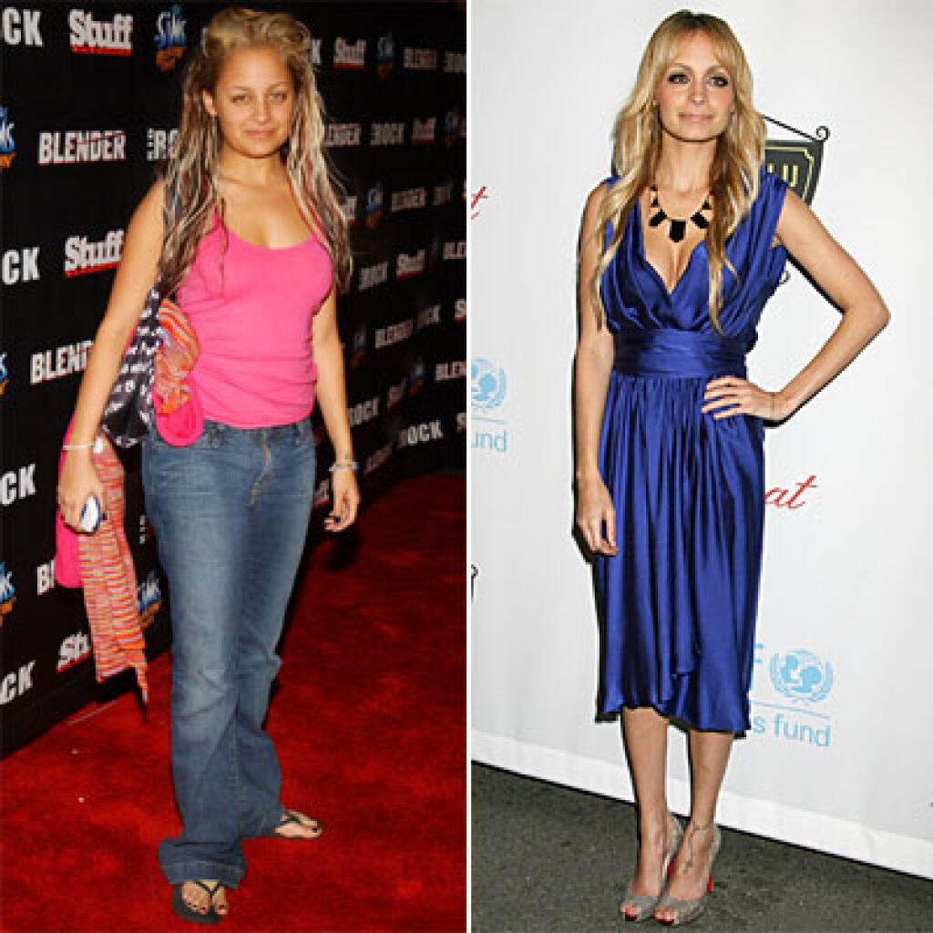 Звезды с анорексией фото до и после