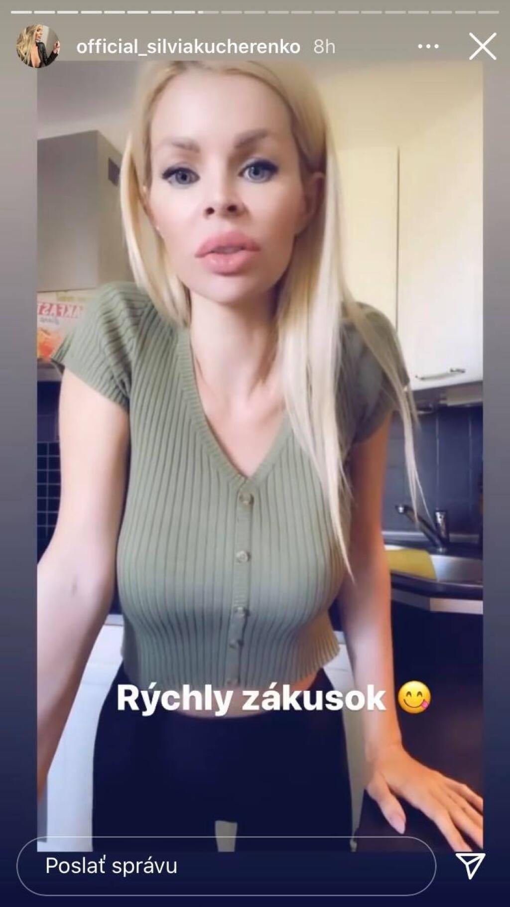 Prirodeznosť Silvii Kucherenko dlho nevydržala. Opäť má akési väčšie pery.