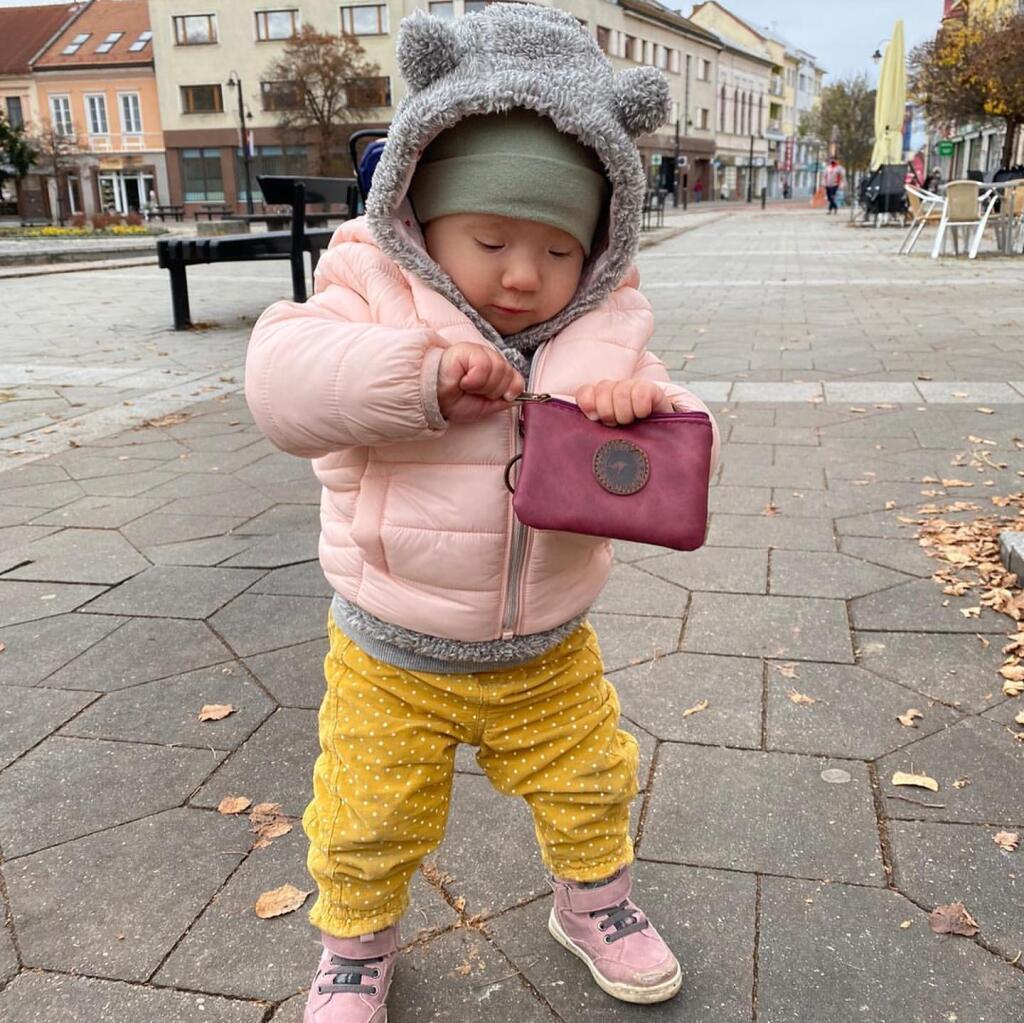 Syndróm malého oka nemá vplyv na zrak malej Lujzy.