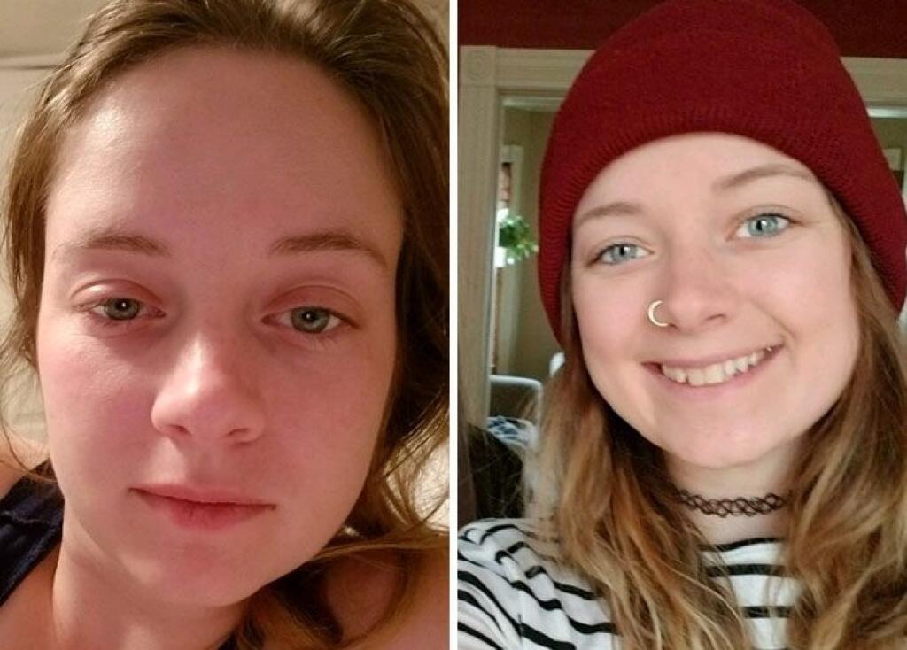 Люди изменившие внешность. Пропитое лицо до и после. Пропитое лицо женщины до и после.
