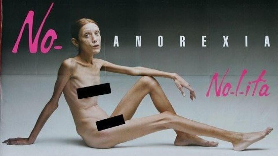 anorexia