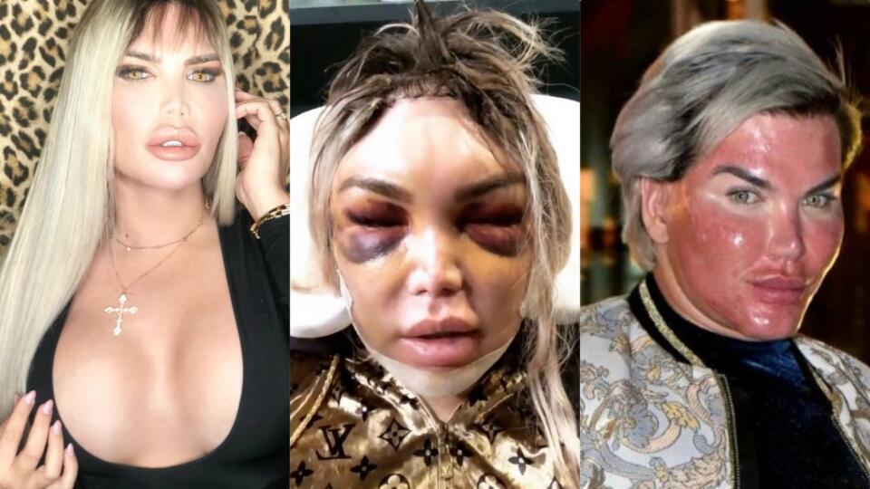 Rodrigo Alves (36)