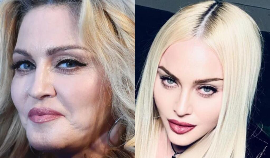 Na novej fotografii, ktorú speváčka zverejnila tento týždeň je tiež viditeľný rozdiel v tvare a veľkosti jej pier. Napriek tomu, že ich mala Madonna už predtým dostatočne plné, dnes sú jej pery ešte o niečo väčšie a rovnako sa mierne zmenil aj ich tvar.