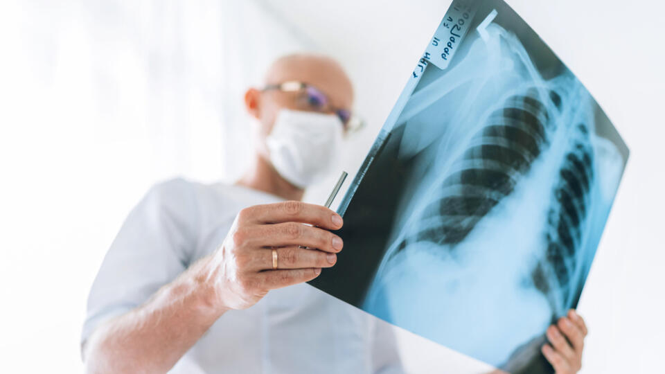 Mature,Male,Doctor,Examining,The,Patient,Chest,X-ray,Film,Lungs