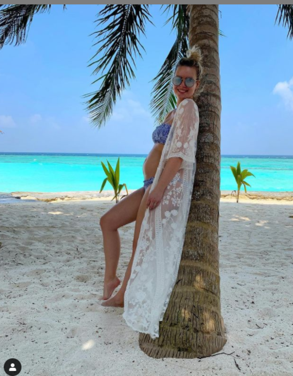 Tehotná Patrícia Pagáčova
