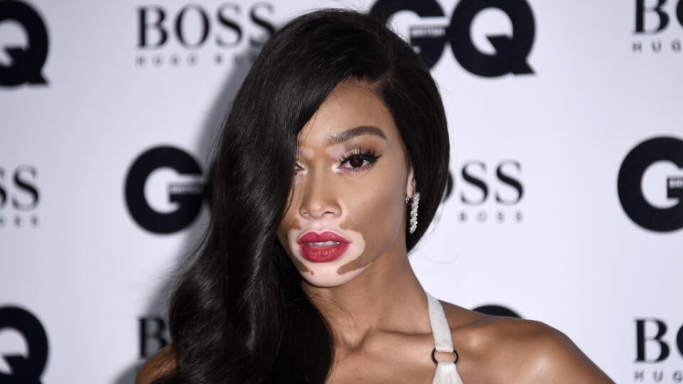 Kanadská modelka Winnie Harlow prezradila svoje kozmetické rituály.