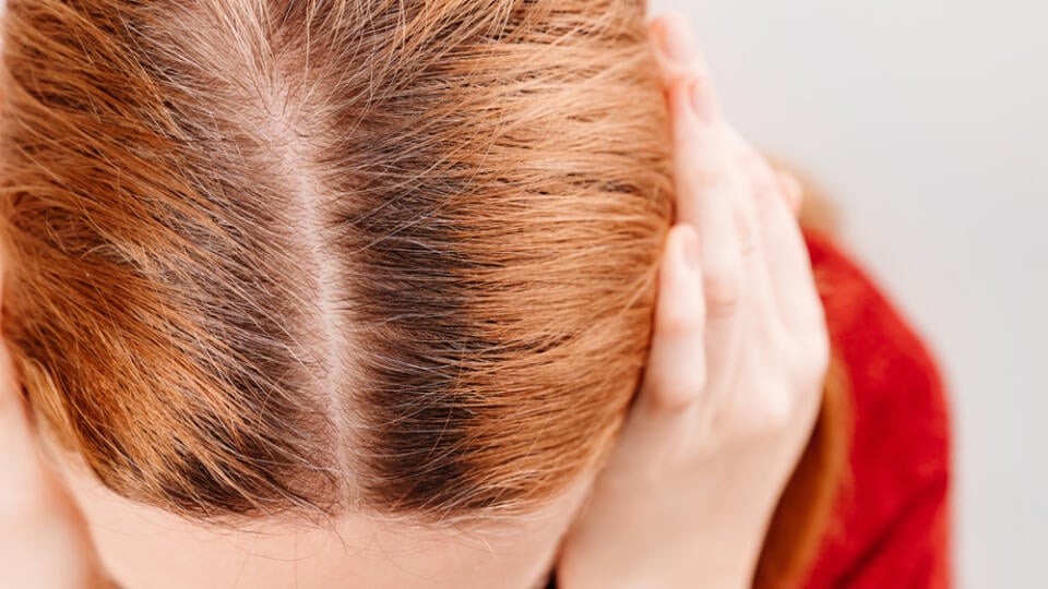 Grown,After,Staining,The,Gray,Roots,Of,Hair,On,The