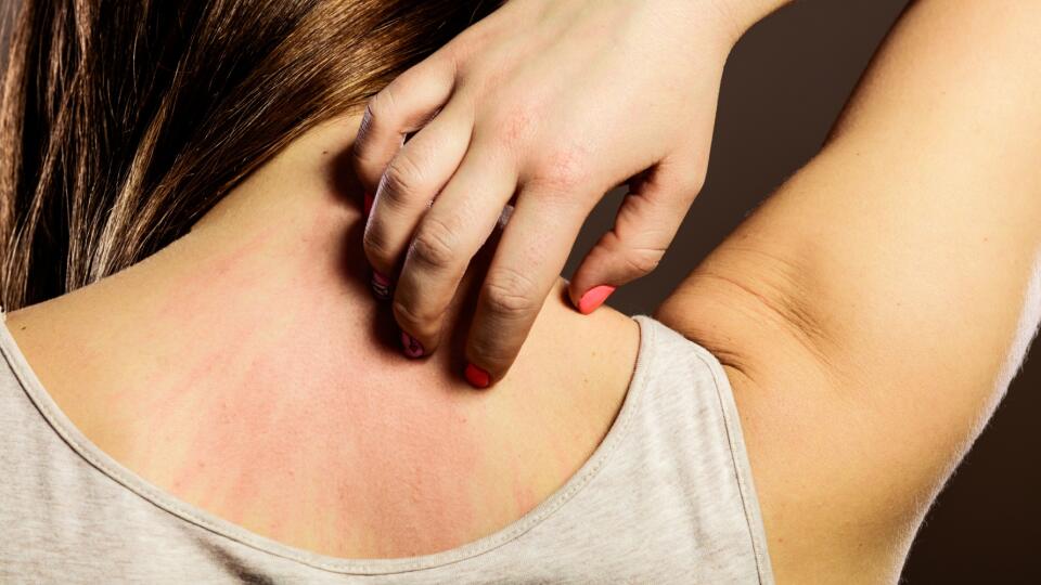 Woman scratching her back closeup