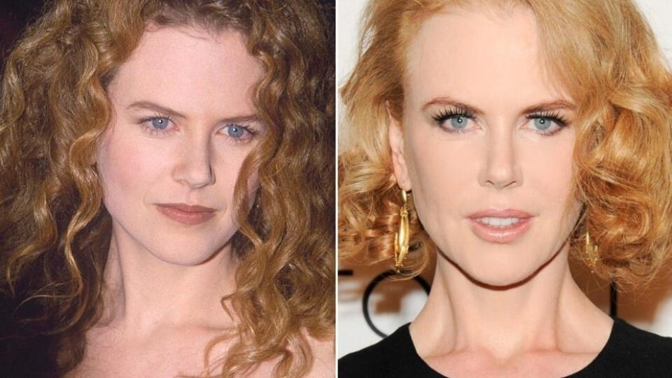 Nicole Kidman v roku 1993 a dnes. Herečka vyzerá