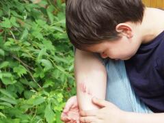 Viete deťom správne ošetriť drobné rany? Rady, ako na to