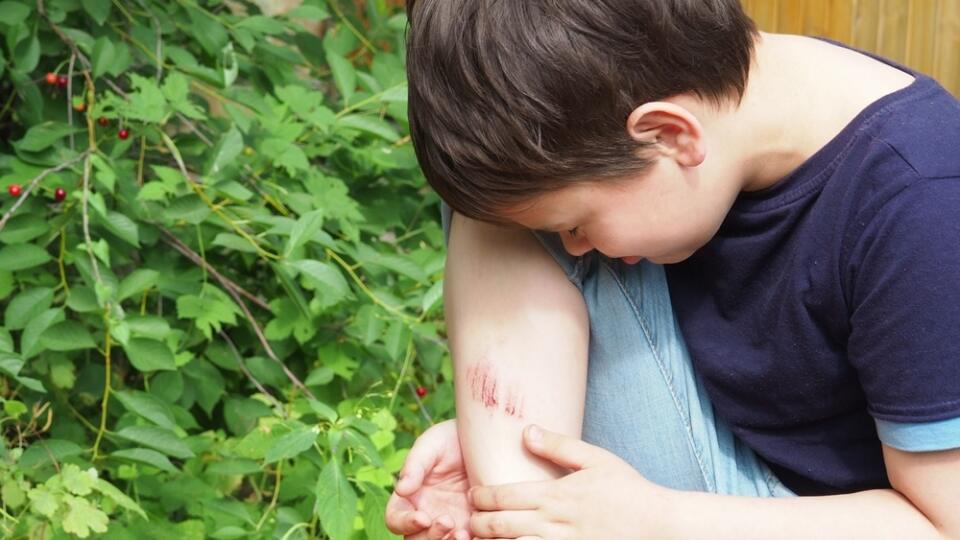 Closeup,Of,Injured,Young,Kid's,Knee,After,He,Fell,Down