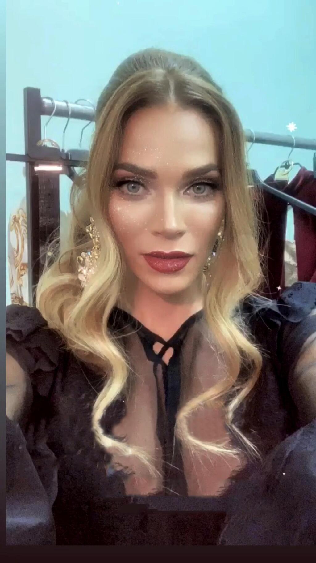 INŠPIRÁCIA Slovenské ženy sa vraj rady umelo dotvárajú kontúrami tváre modelky Kim Kardashianovej. Bez filtra sa nezaobíde ani Andrea Verešová, na snímke.