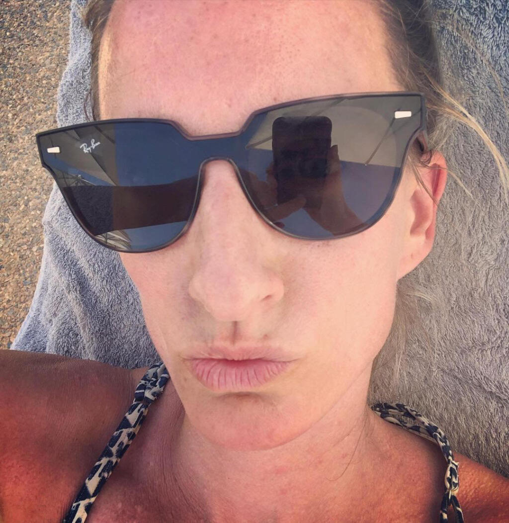 Čo sa ukrýva za skutočným významom Adelinej selfie s našpúlenými perami?