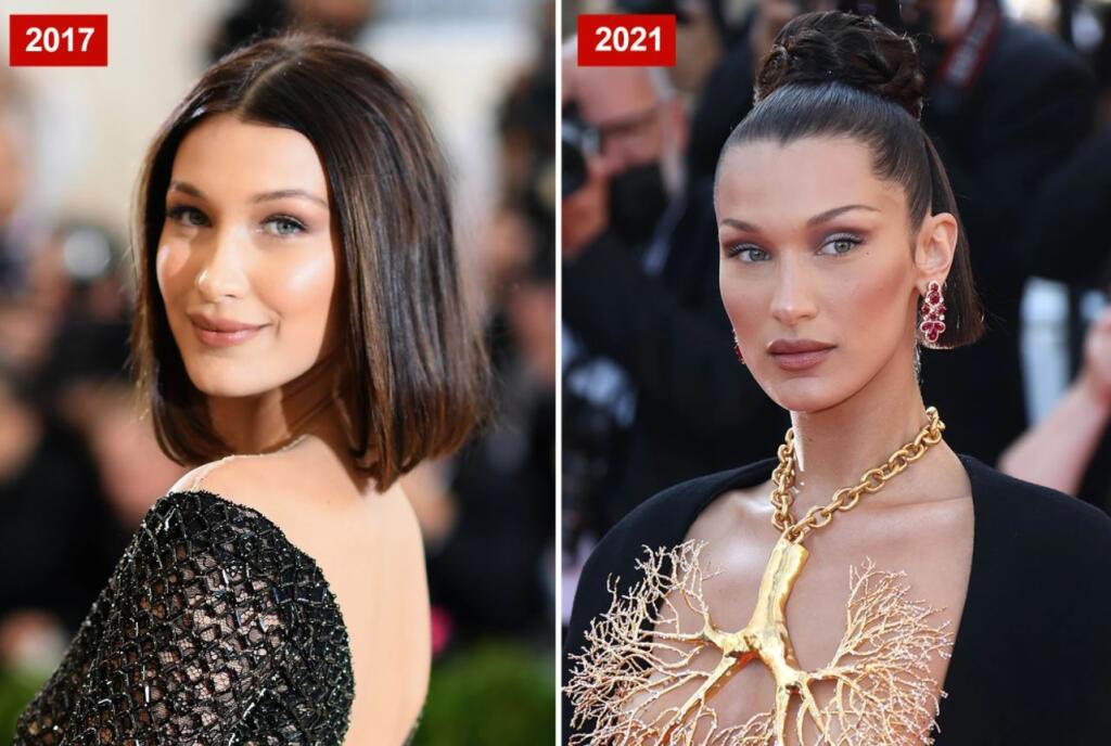 Bella Hadid sa k liftingu očí nepriznáva. Po rokoch sa však jej tvár viditeľne zmenila.