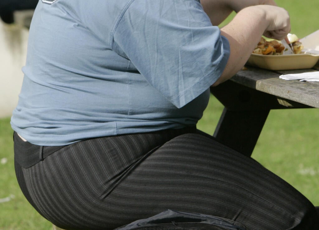 obezita, obézna žena, nadváha, tučnota