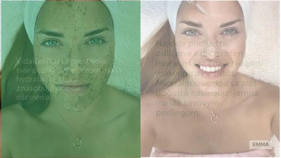 Revolučná metóda v anti-agingu: Doprajte svojej pleti počas jesene nadštandartnú starostlivosť