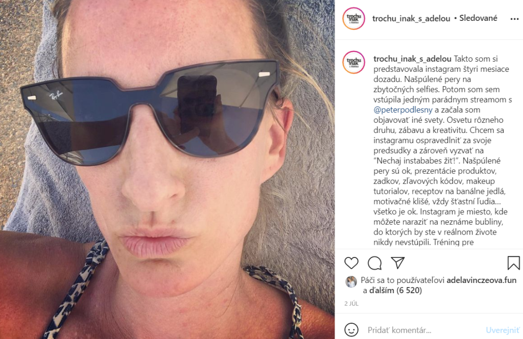 Adela objavila čaro sociálnych sietí a na fotografiách sa ukazuje aj v nie príliš lichotivých pózach.