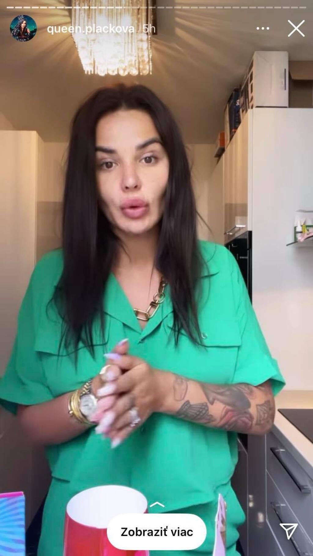 Jún 2021: Zuzana Plačková prvýkrát ukázala tvár po plastike bez štipky mejkapu a skrášľovacích filtrov.