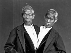 Bizarný príbeh prvých siamských dvojčiat Bunkerovcov: Žili s dvomi ženami, splodili 21 detí