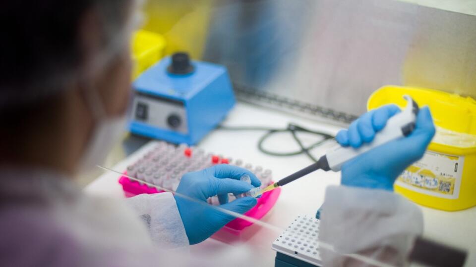 Španielska lieková agentúra schválila vykonanie prvého kola klinických testov vakcíny proti ochoreniu COVID-19, ktorú vyvinula španielska farmaceutická spoločnosť Hipra.