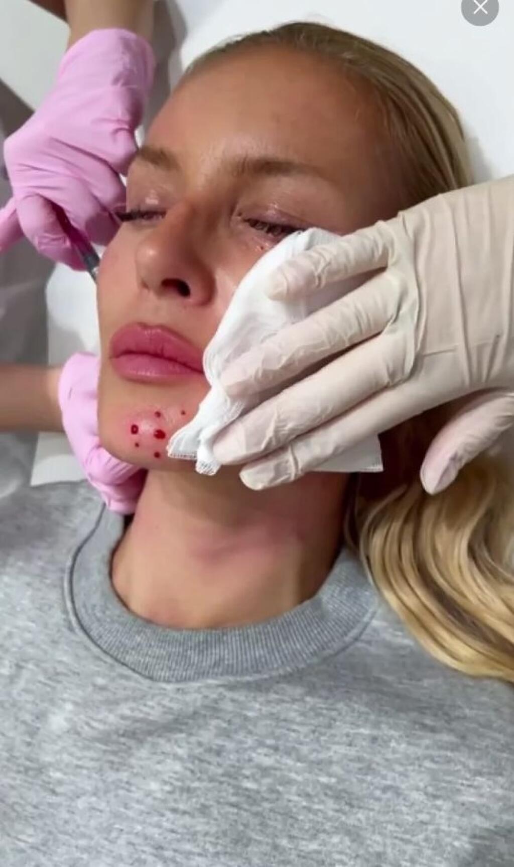 Simona Krainová sa netají tým, že jej robia skrášľovacie zákroky.