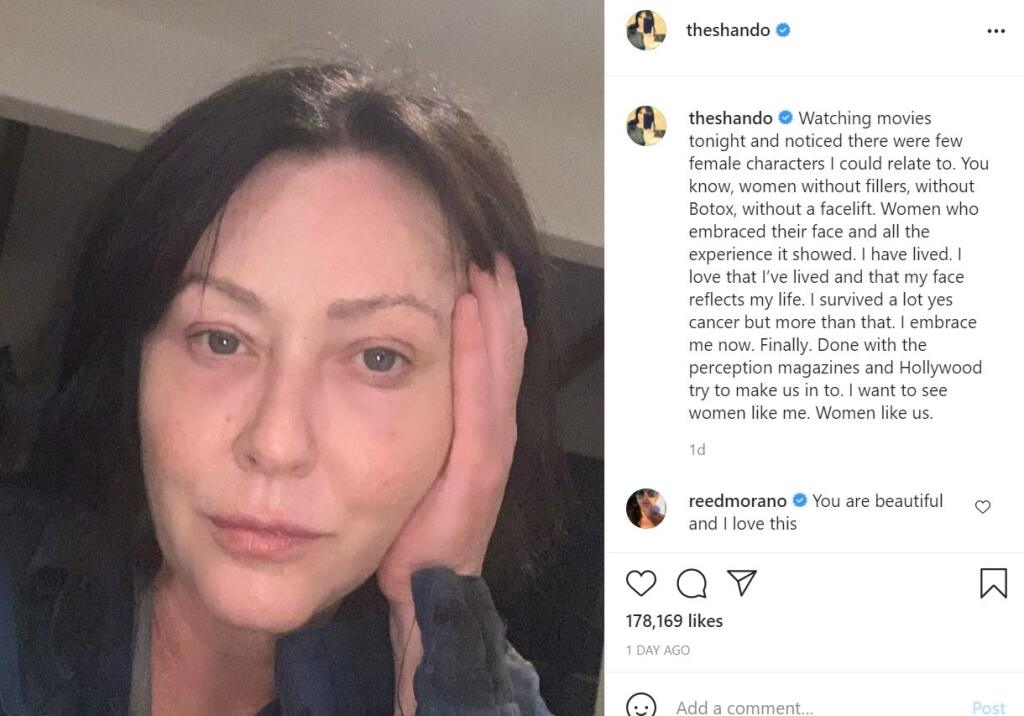 Herečka na sociálnej sieti instagram zverejnila svoju tvár bez mejkapu s dojemnými slovami o jej boji s rakovinou. S filmovými kráskami sa už stotožniť nedokáže.