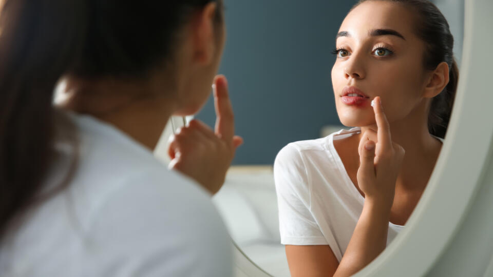 Young,Woman,With,Herpes,Applying,Cream,On,Lips,In,Front