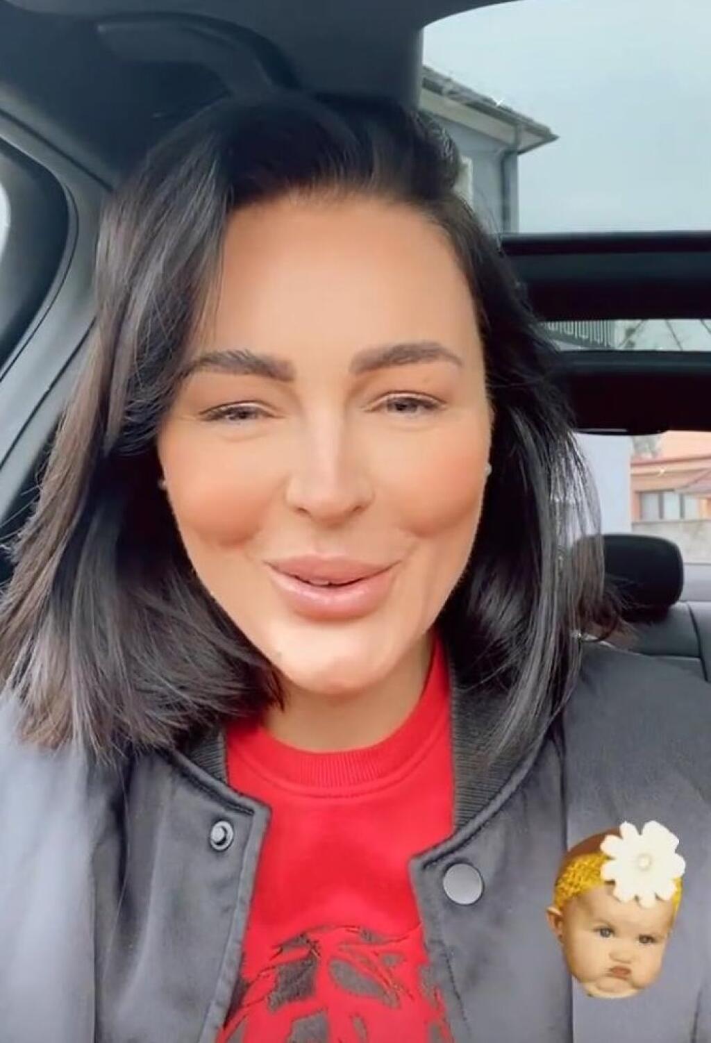 Na pravidelnú korekciu tváre chodí na estetickú kliniku aj Kristína Kormúthová.