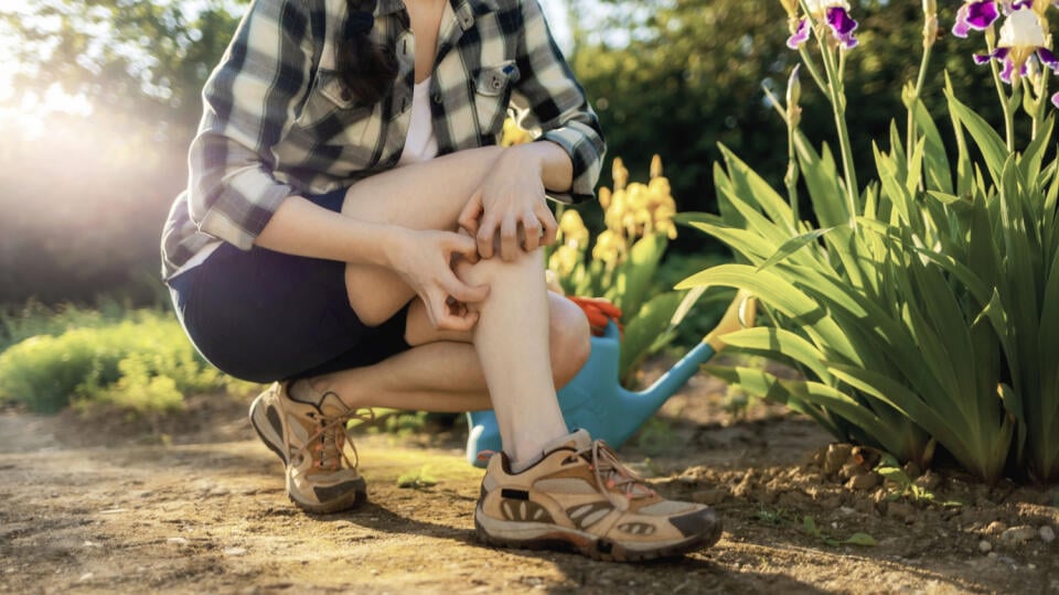 Summer season. Woman scratches her leg, which is itchy from a mosquito bite. Close up of legs. Outdoor. Allergies and insect bites concept.