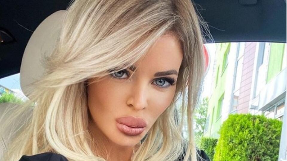 Silvia Kucherenko: Najskôr zmenila farbu vlasov z platinovej na špinavú blond. Potom si dala zmenšiť kačacie pery. Takto vyzerá návrat k akej-takej prirodzenosti plastikovej modelky barbie.