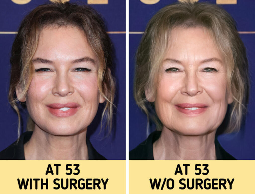 Renée Zellweger