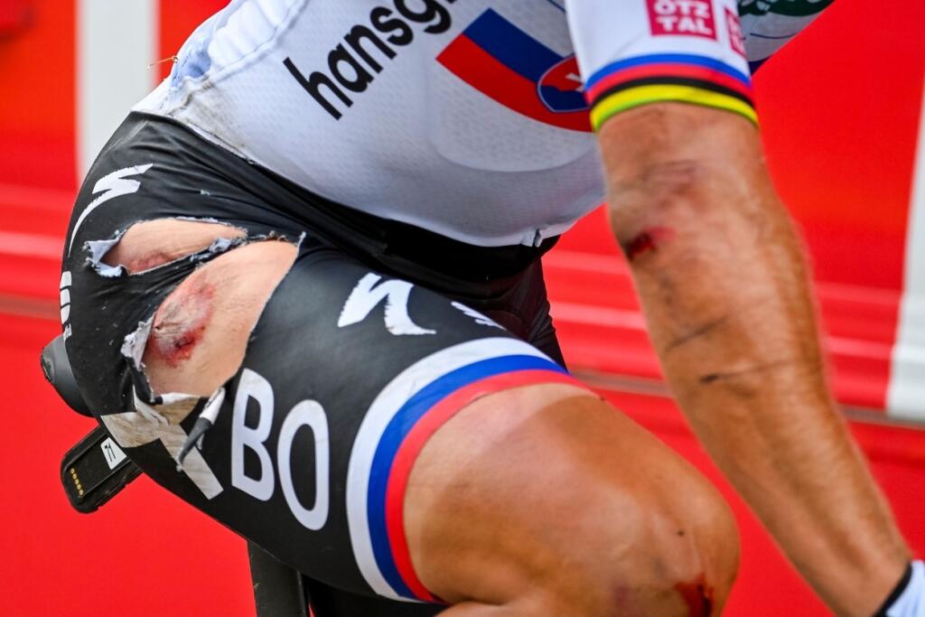 Peter Sagan po páde v 3. etape Tour de France.