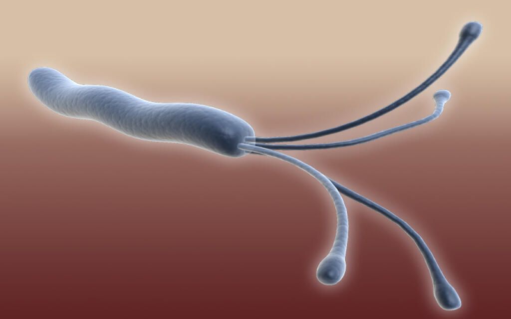 Se puede tener sibo y helicobacter pylori