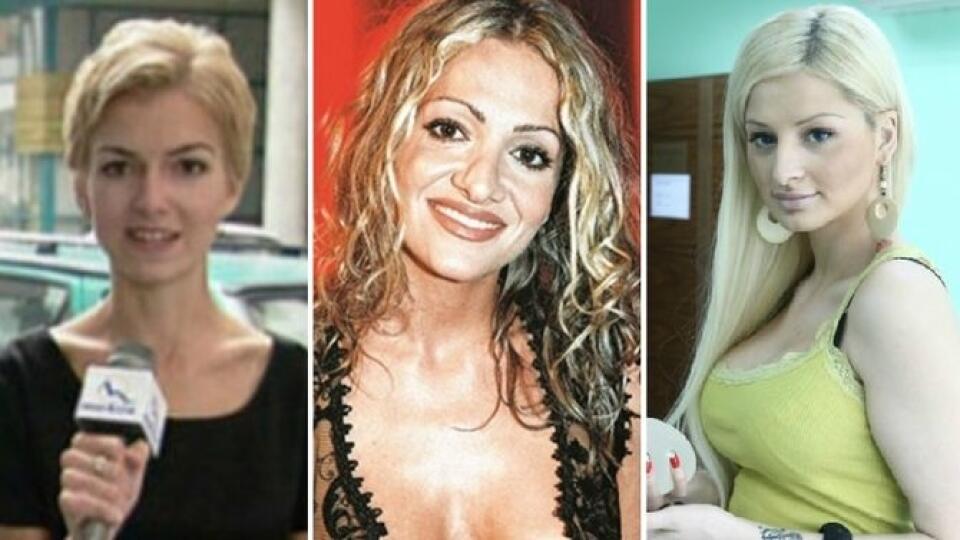 Niektoré naše celebrity podstúpili radikálne zmeny.
