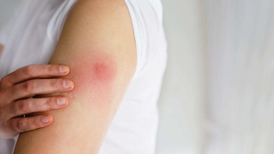 Opuchu a bolesti ramena dokáže zabrániť šikovný trik tesne pred očkovaním.