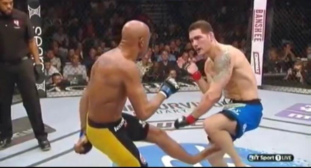 Zápasník UFC Anderson Silva ešte v roku 2013 utrpel vážne poranenie nohy.