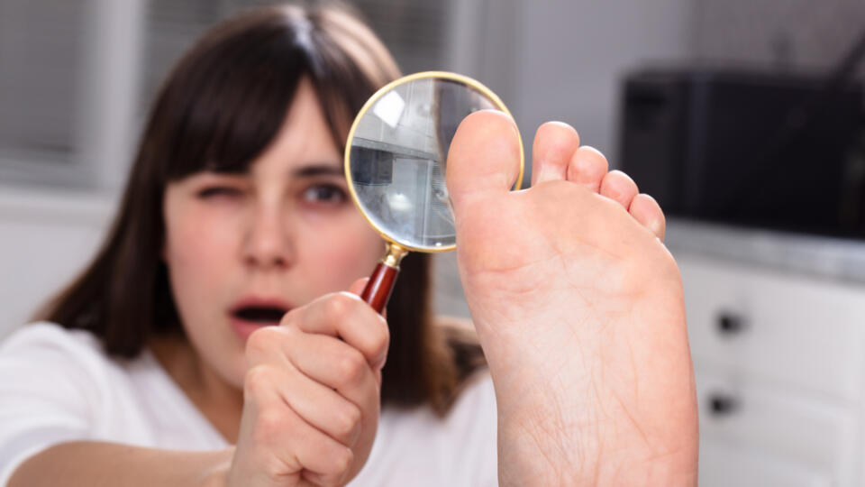 Shocked,Young,Woman,Looking,At,Her,Toe,Nails,With,Magnifying