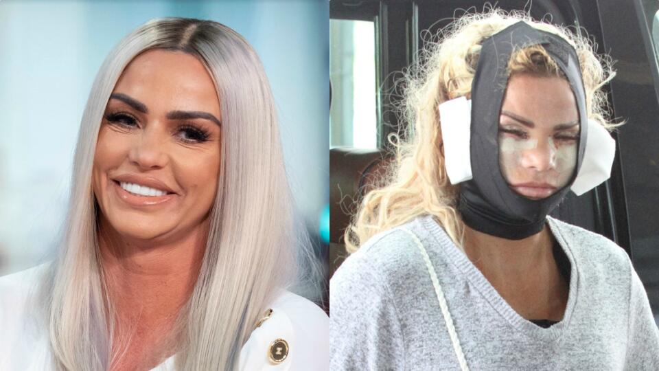 Katie Price je čerstvo po operácii. Jazvy ukázala celému svetu.