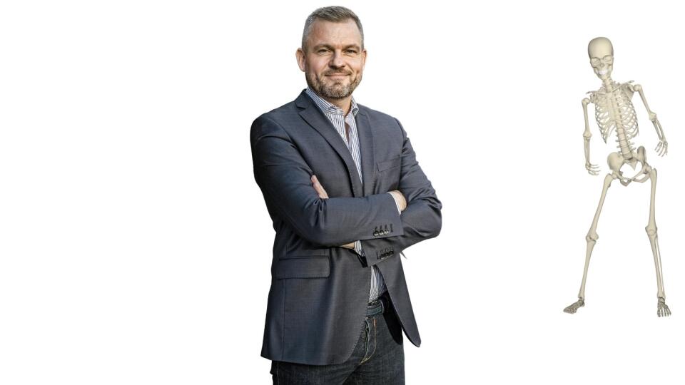 Možno aj Peter Pellegrini má v skrini nejakých kostlivcov z minulosti