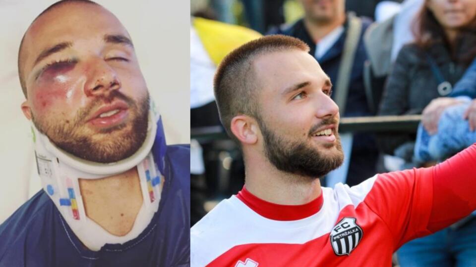 Brankár Petržalky Frederik Valach sa vracia po hororovom zranení späť na trávniky. „Bol to najdlhší čas bez futbalu v mojom živote. Veľmi ťažké obdobie. Už sa neviem dočkať toho, kedy už vybehnem na ihrisko,
